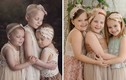10 bức ảnh khác biệt trước và sau khi đánh bại ung thư 