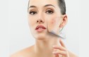 8 công thức mặt nạ trị khuyết điểm để da đẹp không tì vết