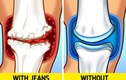 Diện jeans bó sát, người mặc khổ vì “phá” dáng, “đầu độc” sức khỏe