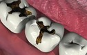 Top các bệnh răng miệng nguy hiểm dễ tấn công người già