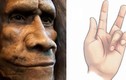 Giải bí ẩn “căn bệnh Viking”: Có nguồn gốc từ người Neanderthal?