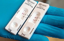 Test nhanh 2 vạch nhưng xét nghiệm PCR âm tính: BS chỉ rõ lý do