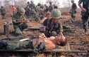 Khốn khổ lính quân y Mỹ trong chiến tranh Việt Nam