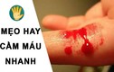 Tuyệt chiêu cầm máu nhanh ít người biết