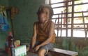 Cụ bà 91 tuổi mang “gương mặt quỷ” ở Quảng Nam