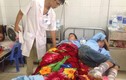 Thanh Hóa: 75 người bị bỏng nhập viện vì đốt lửa trại