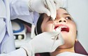 4 thời điểm bạn sẽ gặp nguy hiểm khi nhổ răng