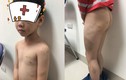 Hà Nội: Nghi vấn bố đánh con đẻ 7 tuổi bầm tím