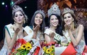 Người đẹp “dao kéo” thi hoa hậu quốc tế: Đến lúc bật đèn xanh?