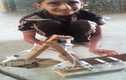Cậu bé chế tạo máy xúc hoạt động bằng kim tiêm
