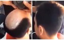 Cách trị hói đầu có một không hai của thợ cắt tóc