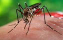 Những điều cần biết về virus Zika cực nguy hiểm