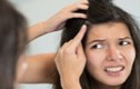 3 bí quyết ngăn ngừa tóc bạc sớm chẳng tốn tiền