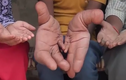 Cậu bé 12 tuổi có đôi bàn tay khổng lồ gây kinh ngạc