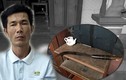 Nghi phạm chém 4 người ở Nghệ An có bệnh án tâm thần 
