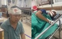 Truy bắt nhóm đối tượng đánh trọng thương 5 công nhân ở Lào Cai