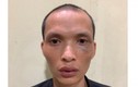 Hà Nội: Đã bắt được kẻ dùng kim tiêm đe dọa cướp điện thoại 