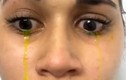 Cô gái hốt hoảng khi khóc ra nước mắt màu vàng 