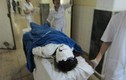 6 người bị bỏng nặng nhập viện bất thường ở Quảng Ninh