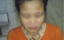 Chồng bạo hành xích cổ vợ ở Thái Bình khiến nhiều người phẫn nộ