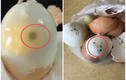 Trứng gà ăn theo cách này dễ rước họa vào thân