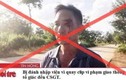 “Bị đánh nhập viện vì quay clip vi phạm giao thông” là tin giả