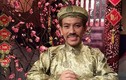Diễn viên hài Đăng Lưu bị hôn mê