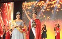 Hoa hậu Hoàn cầu Trung Quốc 2015 bị chê răng hô