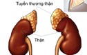 Lạm dụng thuốc giảm đau, bệnh nhân suy tuyến thượng thận