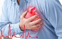 Những thói quen xấu khiến người trẻ dễ bị nhồi máu cơ tim