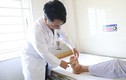 Người đàn ông bị biến dạng tứ chi do bệnh gout