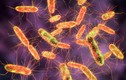 80 sinh viên ở Lào Cai ngộ độc, “thủ phạm“ là vi khuẩn Salmonella