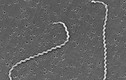 Suýt mất mạng do nhiễm Leptospira - hiểm hoạ từ chuột, ai dễ mắc?