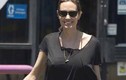 Rộ tin Angelina Jolie gặp biến chứng sau tái tạo ngực