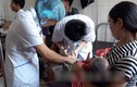 Ăn cỗ cưới ở Yên Bái, 64 người nhập viện vì ngộ độc 