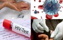 Ngay khi phát hiện phơi nhiễm HIV, cần phải làm gì?