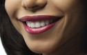 ​9 nguyên tắc vàng để hàm răng luôn trắng khỏe