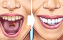 10 cách đơn giản giúp loại bỏ cao răng tại nhà
