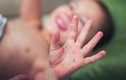 Trẻ bị tay chân miệng trở nặng do chủng vi rút nguy hiểm tái xuất 