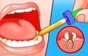 10 mẹo giảm đau hiệu quả khi mọc răng khôn