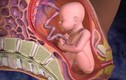 Cảnh báo nguyên nhân và dấu hiệu dẫn đến suy thai mẹ bầu cần thận trọng
