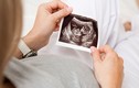 Quảng Nam: Bà bầu đi đẻ mà không có thai, “lặp” điệp khúc chửa giả?
