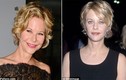 Khuôn mặt của Meg Ryan ngày càng biến dạng