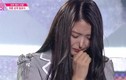 Nữ ca sĩ trẻ Hàn Quốc lộ chiếc mũi lạ thường