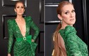Celine Dion không giấu được vẻ già nua ở tuổi U50