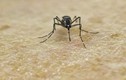 Mỹ ghi nhận trường hợp tử vong đầu tiên do virus Zika