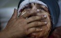 20 bức ảnh “sốc” về chiến tranh Syria