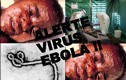 Tiết lộ bất ngờ về tên gọi virus Ebola 