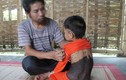 Xót xa bé gái 5 tuổi mọc lông như 'người rừng' ở Nghệ An
