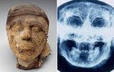 Lời giải gây sốc về xác ướp bí ẩn 4.000 tuổi 